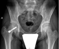  X rays-slip