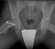  X rays-slip